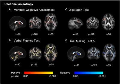 White matter and gray matter changes related to cognition in community populations